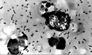 microscopic image of fleas